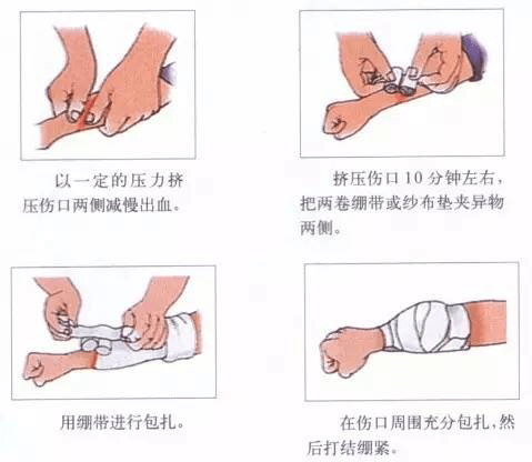 家庭急救指南，切割傷的止血與急救技巧