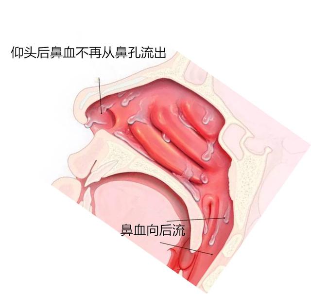 小面積燒傷的家庭急救處理方法