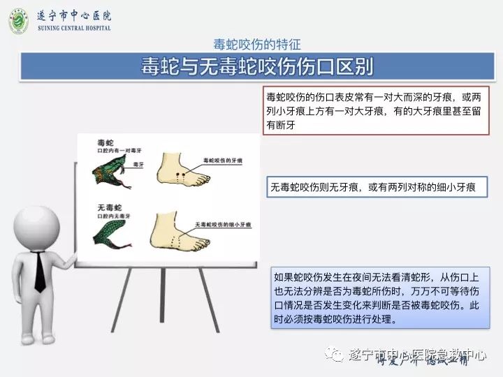 毒蛇咬傷時的應急處理與急救方法